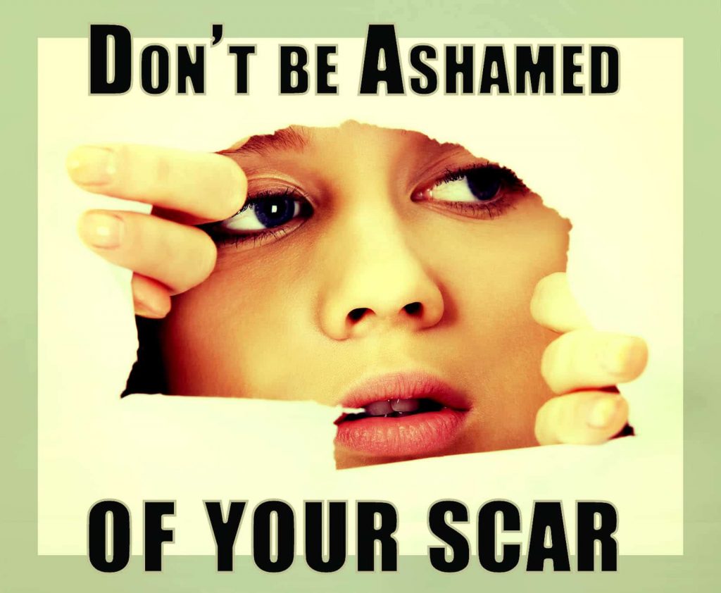 Be Proud of Your Scar